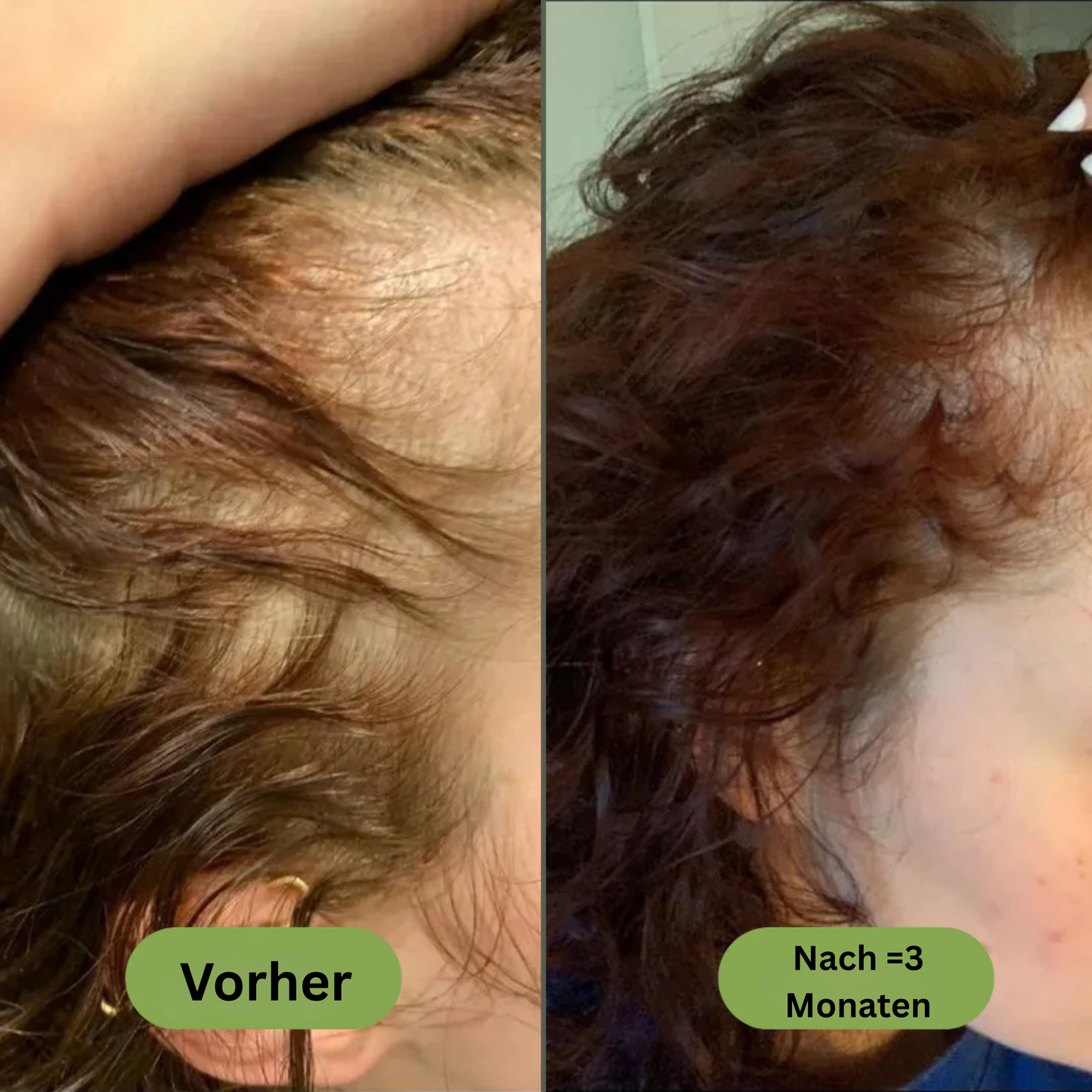 Royal Vital™ Botanisches 16 Öl Haarwuchsserum