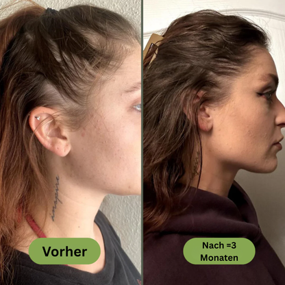 Royal Vital™ Botanisches 16 Öl Haarwuchsserum