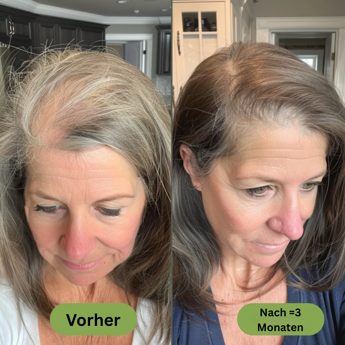 Royal Vital™ Botanisches 16 Öl Haarwuchsserum