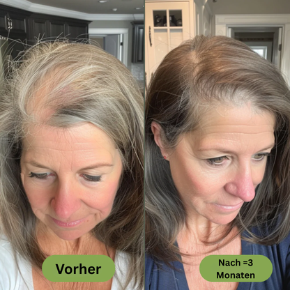 Royal Vital™ Botanisches 16 Öl Haarwuchsserum