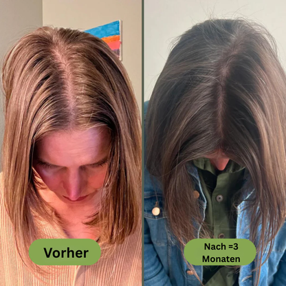 Royal Vital™ Botanisches 16 Öl Haarwuchsserum